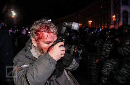 У сутичці на Грушевського постраждали більше двох десятків журналістів