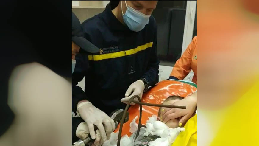 Рятувальники зрізали металеву конструкцію, що знаходилася у шиї 6-ти річної дитини